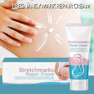 Stretch Mark Cream Stretch Marks Removal Cream Belly Cream Pregnancy Skin Care