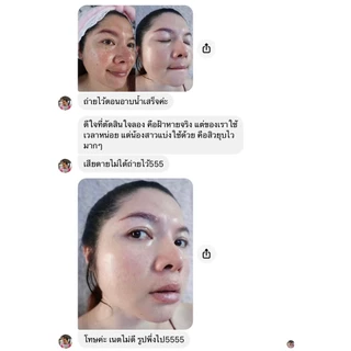 แจกโปร ส่งฟรี Hayeong + Serum Nano + Soap ฮายอง ครีมฝ้า เซรั่มสิว สบู่ผิวหน้า บำรุงผิวหน้า หน้าขาว