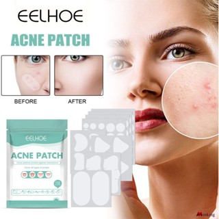 Eelhoe Acne Mask Patch Fade Acne Marks Acne Patch แผ่นแปะสิวไม่ระคายเคือง Acne Repair Patch (monkingstore_th)