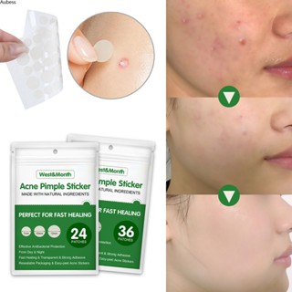 Ready West Month Acne Pimple Patch สติกเกอร์รักษาสิวสติกเกอร์กันน้ำที่มองไม่เห็น Pimple Remover Daily Use Serein