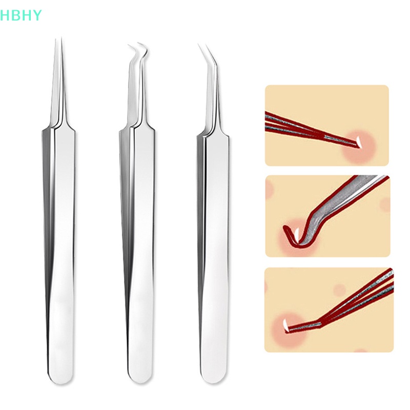 HB แหนบ Blackhead Pimples Removal Pointed Bend Face Care เครื่องมือ HY