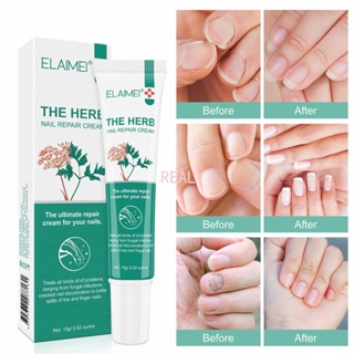 CYREAL Elaimei Nail Repair Cream Essence เพื่อซ่อมแซมเล็บแตก,เล็บที่เปราะบาง,เล็บเชื้อรา,แยกเล็บที่ไม่ดีได้อย่างรวดเร็วยับยั้งเชื้อรา