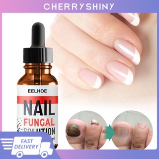 พร้อมสต็อก Eelhoe Nail Fungus Repair Liquid Foot Anti-fungal Essence Onychomycosis Repair Liquid Healthy Nail Care Repair Liquid