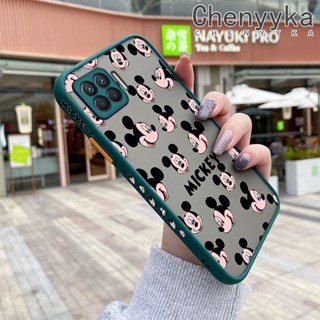 เคสโทรศัพท์มือถือ ซิลิโคนนิ่ม ใส กันกระแทก เต็มจอ ลายหนู สําหรับ OPPO A93 2020 F17 Pro Reno 4F Reno 4 Lite