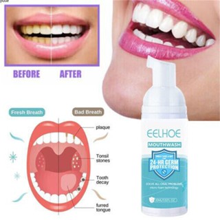 Eelhoe Teethaid Mouthwash, Mint Teeth Whitening Foam Mousse Stain Remove Uk puueqg