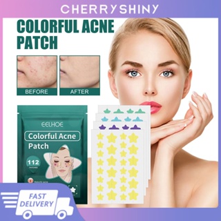 Eelhoe 112pcs Paste Star Patch Fade ลดการเกิดแผลเป็น Skincare Beauty Tools