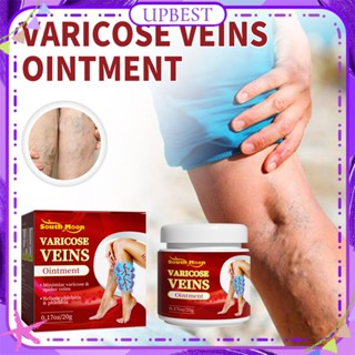 ♕ South Moon Varicose Vein Ointment Minimize Spider Earthworm Leg บรรเทาอาการปวดขาบวมส่งเสริมการไหลเวียนโลหิตครีมบำรุงผิวกาย 20g UPBEST