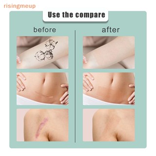 [risingmeup] สติกเกอร์รอยสัก ปกปิดจุดด่างดํา รอยสัก รอยแผลเป็น กันน้ํา