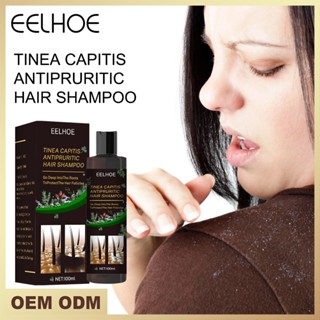 Hot Sale# eelhoe tinea capitis antipruritic shampoo anti-dandruff oil control antipruritic shampoo anti-removal oil control refreshing shampoo 8.26Li