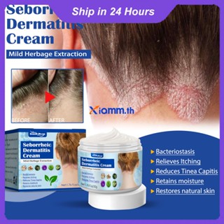 Richanghuodong South Moon Seborrheic Dermatitis Cream Head Acne Repair Hair Follicles Pruritus Scalp Ringworm Psoriasis Eczema Skin Ointment For Head Skin Treatment - ครีมบำรุงผิวหน้า