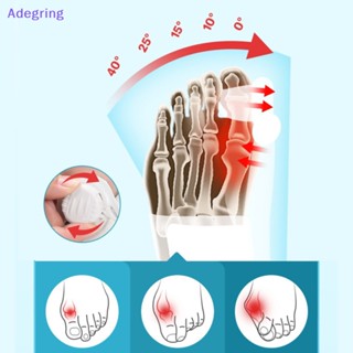 [Adegring] อุปกรณ์เฝือกปรับขนาดนิ้วเท้า ปรับขนาดได้