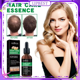 ♕ Eelhoe Ginger Hair Care Essence ลดผมร่วง กระตุ้นการงอกของเส้นผม บำรุง ให้ความชุ่มชื่นแก่หนังศีรษะหัก Essence Natural Ingredient Hair Care 30ml UPBEST