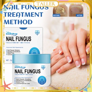 ✧ Ready Stcok South Moon Nail Fungus Treatments ครีมเซรั่ม Anti Fungal Anti-Infection Onychomycosis Paronychia Foot Toe Nails Repair Gel Body Care 20G สูง