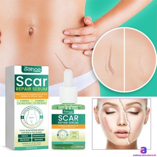 Eelhoe Scar Repair Essence เจือจาง Bump Scar Repair Acne Pit Acne Print Skin Tender Essence AUBESSTECHSTORE AUBESSTECHSTORE