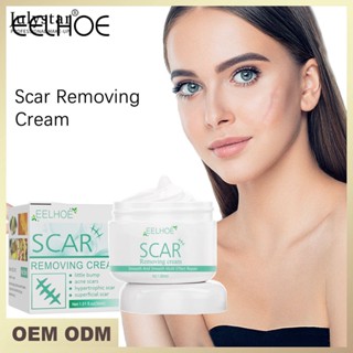 JULYSTAR Eelhoe Scar Repair Cream Fade Pigmentation To Burn Old Scars Post-surgery Skin Smoothing Repair บำรุงผิวให้เรียบเนียน