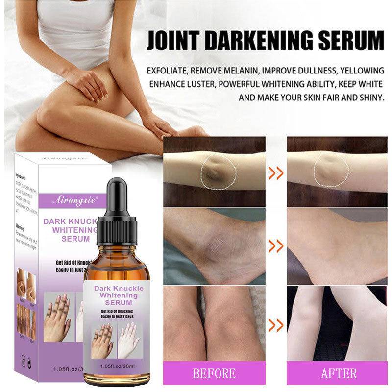 แอร์งซี่® Dark Knuckle Whitening Strong Whitening สําหรับ Dark Knuckle Fingel สําหรับถอด Dark Elbow 