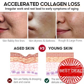 Vibrant GLAMOUR Retinol เอสเซ้นต์โทนเนอร์ ต่อต้านริ้วรอย ยกกระชับผิวหน้า P2P9