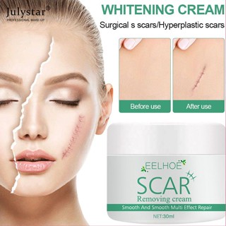 JULYSTAR Eelhoe Scar Removal Cream ครีมซ่อมแซมแผลเป็นจากสิว สิวเสี้ยน รอยแตกลาย รอยแผลเป็นจากการเผาไหม้ ส่งเสริมการสร้างเซลล์ใหม่ ให้ความชุ่มชื้น Smoothing Repair Gel