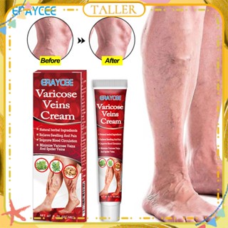 ✧Ready Stcok Eraycee Varicose Veins Cream บรรเทาอาการปวดขาไส้เดือน ปวดบวม ครีมต้านการอักเสบ ส่วนผสมจากธรรมชาติ Treatment Body Care TALLER