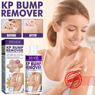 Keratosis Pilaris ครีมซ่อมแซมผิวหน้า ให้ความชุ่มชื้น B6X4