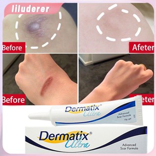 15g Dermatix Scar Cream Repair Acne Stretch Marks Burning Scars ศัลยกรรมแผลเป็น Smoothing Whitening Cream Moisturizing Body Lotion ผิว HO