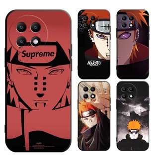 OnePlus Nord 100 Nord CE 3 CE 2 2lite 1+11 1+10 Pro 1+10T เคสนิ่ม