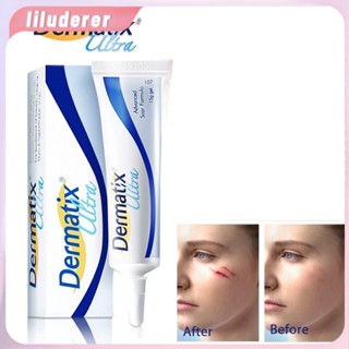 Dermatix Ultra Gel 15gm *เจลรักษาแผลเป็นขั้นสูง Anti Acne Spot Care HO