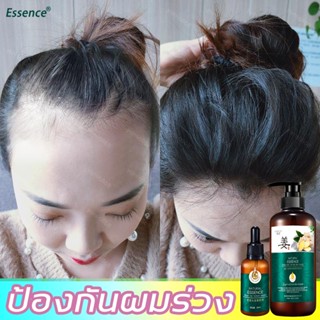 ป้องกันผมร่วง+เซรั่มปลูก🥇แชมพูแก้ผมร่วง EESSENCE แชมพูขิง 500MLแชมพูสมุนไพร เร่งผมยาว ใช้ได้ทั้งชายหญิง เซรั่มปลูกผม