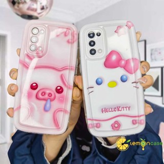 เคสโทรศัพท์มือถือแบบนิ่ม TPU กันกระแทก ลายเฮลโลคิตตี สําหรับ Realme C21Y C30 C30S C31 C33 C35 C11 2021 C15 C21 C25 C20 C3 C12