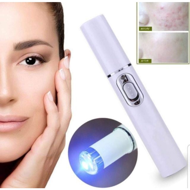 เครื่องเลเซอร์หน้าใส ปากกาเลเซอร์รักษาสิว ลบรอยแดงรอยดำจากสิว รุ่น Blue light Acne Treatment-14oct-J1