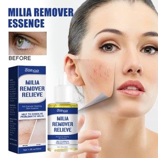 Milia Remover น้ํามัน Milia Spot Treatment for Eye, Milia Treatment, Sebaceous Hyperplasia Treatment 30 มล.