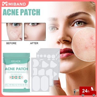 Eelhoe 132 Pcs Acne Patch Mask Face Care Women Student Natural Fade Imprint Patch Acne Repair Veneer Care Products ผลิตภัณฑ์ดูแลผิวหน้า