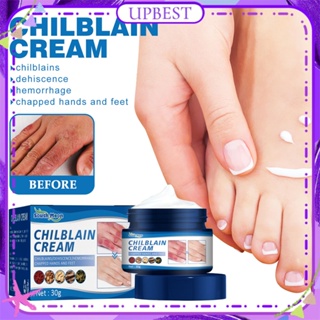 ♕ South Moon Chilblain Cream Anti Drying Crack Foot Heel Hand Repair Cream Moisturizing Skin Removal Dead Skin Anti-bleeding Treatment Winter Body Care UPBEST ซื้อทันที เพิ่มลงในรถเข็น