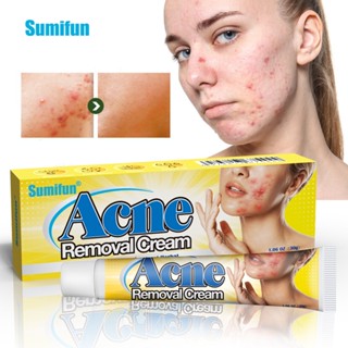 Shopkeepers selection# sumifun plasters AliExpress acne acne acne removing plasters acne removing plasters nursing K101358.21N