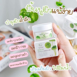 [Daily optimization] Thailand pontina Centella asiatica facial repair gel cream cool and refreshing facial acne marks dark acne marks 8/21