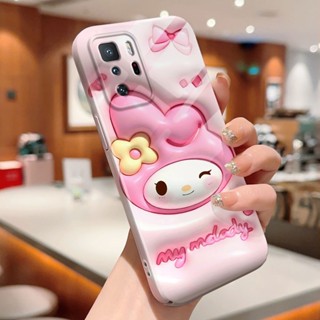 เคสโทรศัพท์มือถือแบบแข็ง กันกระแทก ลายการ์ตูน Pochacco Melody Kuromi Kitty สําหรับ Xiaomi 10 12 Pro 11 Lite 5G NE Poco F2 Pro F4 X3 NFC X3 Pro