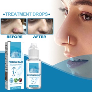 Yagami Stitch 2pcs 30ml Piercing Bump Drops บรรเทาอาการแดงบวมเจาะ Aftercare Treatment Solution