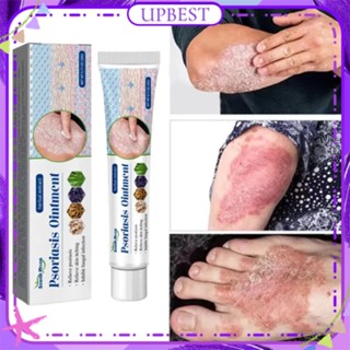 ♕South Moon Psoriasis Cream Skin Antipruritic ลดรอยแดงบวมเปียก Prickly ความร้อนสมุนไพรธรรมชาติ Treatment Body Care 20G UPBEST