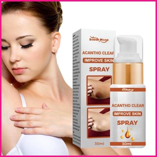 Underarm Lightening มอยส์เจอร์ไรเซอร์บํารุงผิวกาย Acantho 30 มล. ไนไตรแคน จุดด่างดํา ลดจุดด่างดํา ทําให้ร่างกายจางลง