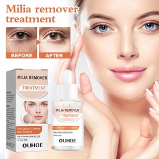 Milia Clearing Essence เอสเซ้นบํารุงผิวหน้า กําจัดรูขุมขน 30 มล.