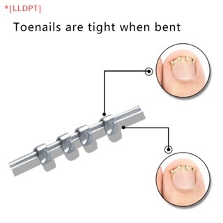 [LLDPT] ใหม่ กรรไกรตัดเล็บเท้าคุด 1 ชิ้น