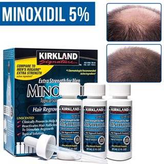 * พร้อมส่ง KIRKLAND Signature Hair Tonic Serum เซรัม ผมร่วง หัวล้าน ปลูกผม ปลูกหนวด สำหรับผู้ชาย 60 Ml,จับคู่หยดเดิม