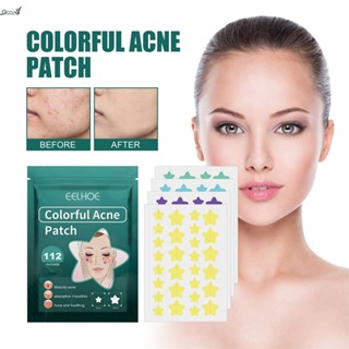 Eelhoe 112 Patches Star Pimple Patch ที่มองไม่เห็น Natural Breathable ไม่อับชื้น ครอบคลุมรอยแผลเป็นจากสิว แผ่นแปะสิว Anti-bacterial qccuot