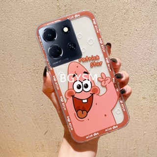 ใหม่ เคสโทรศัพท์มือถือ ซิลิโคนนิ่ม ใส ลายการ์ตูน Sponge Bob Patrick Star น่ารัก สําหรับ Infinix Note 30 VIP INFINIXNOTE30VIP