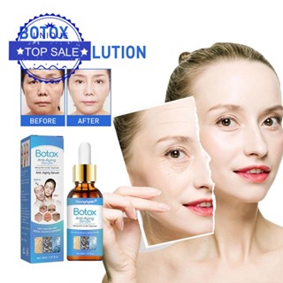 Botox เอสเซ้นคอลลาเจน กําจัดริ้วรอยบนใบหน้า B8F6