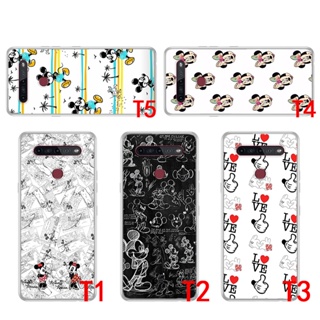 เคสใส แบบนิ่ม ลายการ์ตูนมิกกี้ 40A สําหรับ Infinix Hot 10St 10T X689C Note 7 X690 8 X692 X693 10 Pro X695