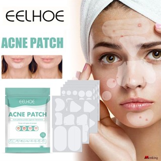 Eelhoe Hydrocolloid Acne Patch เคลียร์สิว กันน้ำ Breathable Acne Skin Repair Patch Closed Mouth Acne Patch (monkingstore_th)