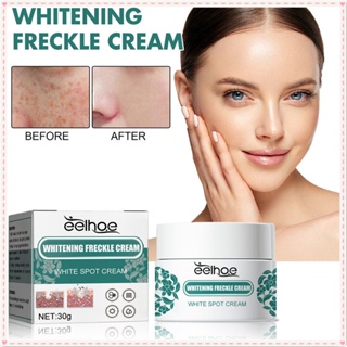 Eelhoe Whitening Freckle Cream Remove Chloasma Acne Spot Pigment Face Cream Anti-wrinkle Brightening Moisturizing Lifting Facial Skin Face Care 30g JOYFEEL ซื้อทันที เพิ่มลงในรถเข็น