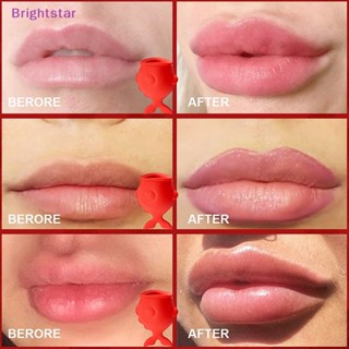 Brightstar ใหม่ อุปกรณ์ซิลิโคน รูปปลา เซ็กซี่ ปากอวบอิ่ม แบบกดด้วยตนเอง สําหรับริมฝีปากอวบอิ่ม