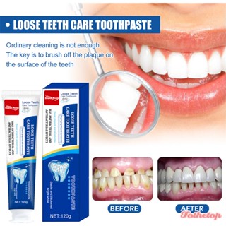 South Moon Gingival Fixation ยาสีฟันบ่มฟันบรรเทาอาการปวดเหงือก [TOP]